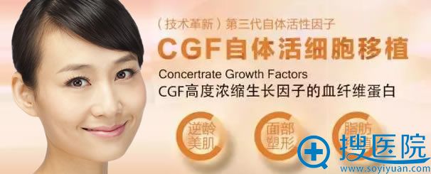 CGFϸ沿